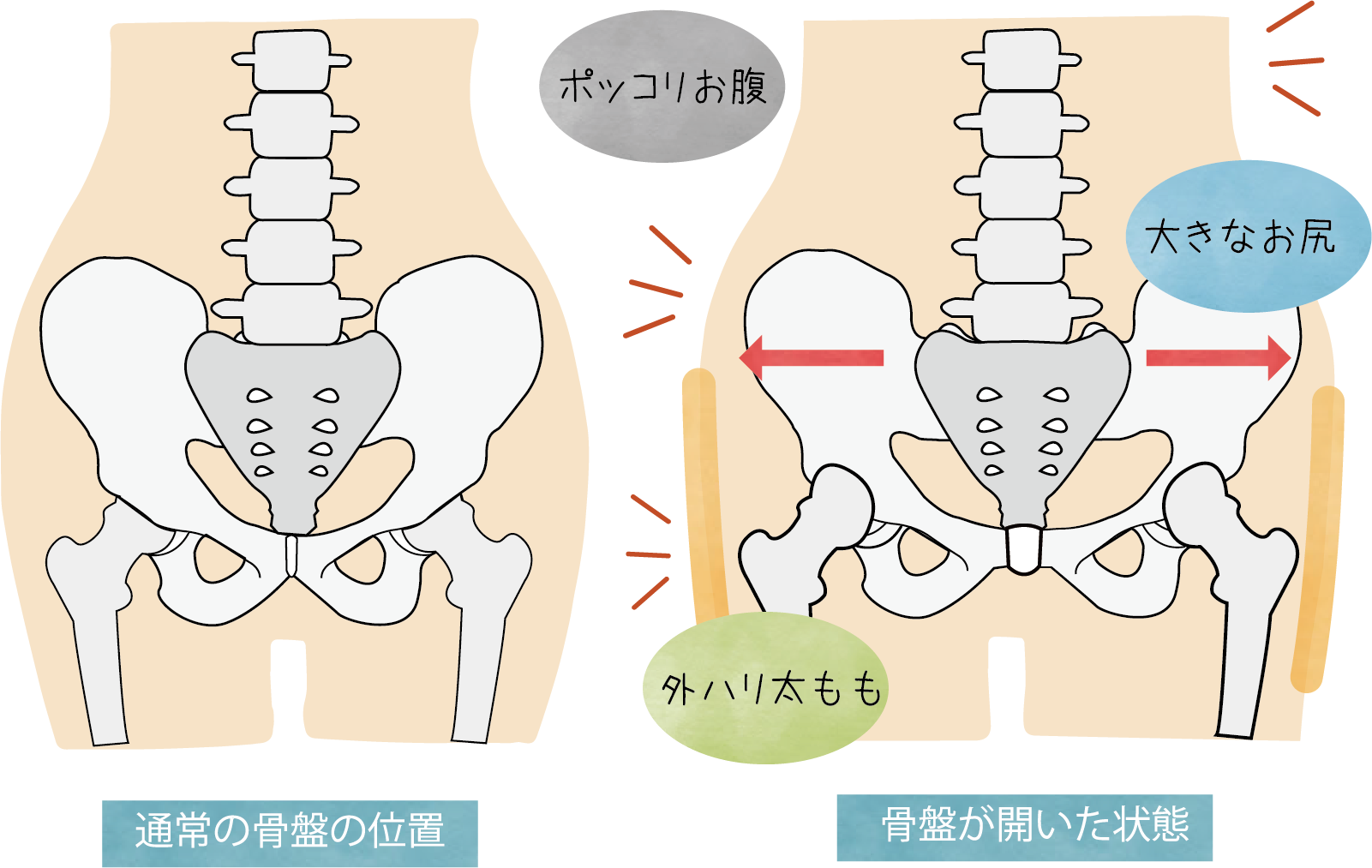 骨盤の位置を正常にすることが美ボディへの近道に！